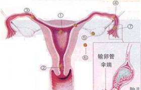 宮頸妊娠 宮頸孕 子宮頸管妊娠