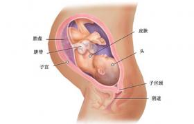 胎兒生長受限 FGR 胎盤功能不良綜合征 胎兒營養不良綜合征