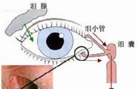 幹眼癥 幹眼 幹眼病 結膜幹燥癥
