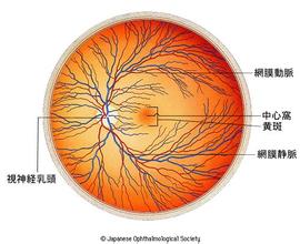 缺血性視網膜疾病 黃斑病變 Rieger中心性視網膜炎 青年性出血性黃斑病變