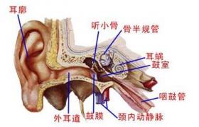 外耳道膽脂瘤 H60.402 外耳道阻塞性角化病 EACC