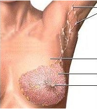 乳腺增生 N62.X03 乳房囊性增生病 小葉增生 乳腺結構不良癥