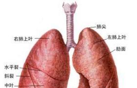 新生兒濕肺 P22.102 第Ⅱ型呼吸窘迫綜合 新生兒暫時性呼吸困難