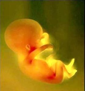 胎糞吸入綜合征 新生兒感染性肺炎 胎糞吸入綜合癥 胎糞吸入性肺炎 胎便吸入綜合征