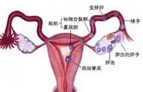 輸卵管阻塞性不孕