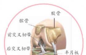 半月板損傷 S83.653 meniscus injury 膝蓋半月板損傷