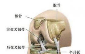 膝關節半月板損傷
