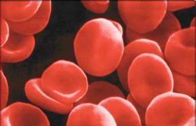 貧血 血虛 anemia
