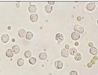 白細胞減少癥 D70.X01
