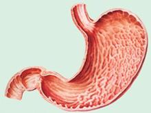 慢性胃炎 K29.502 慢性腸胃炎 慢性胃黏膜炎 胃絡痛