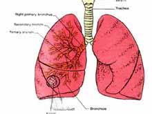 肺囊性纖維化 肺囊性纖維病 肺纖維囊泡癥