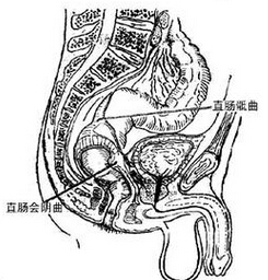 直腸脫垂 K62.302