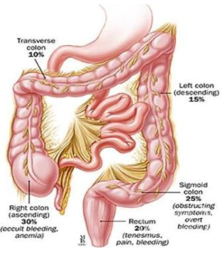 直腸內套疊 不完全性直腸脫垂 隱性直腸脫垂 直腸內脫垂