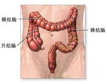 結腸糞性穿孔