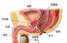 肉芽腫性前列腺炎 N41.151