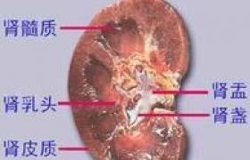 腎皮質髓質膿腫 Renal cortex medulla abscess