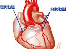 冠狀動脈異位起源 冠狀動脈起源異常