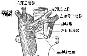 先天性主動脈弓畸形