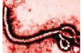 小兒埃博拉病毒病 小兒埃波拉出血熱 小兒埃博拉病毒性疾病