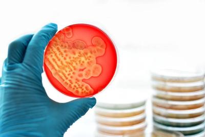 尿細菌培養可以查出淋病嗎
