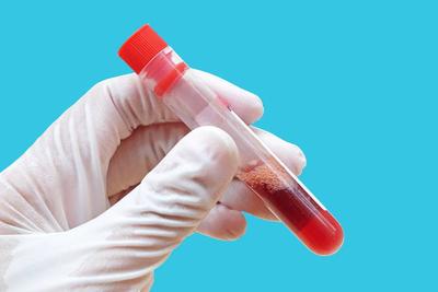 血常規檢查可以查出淋病嗎