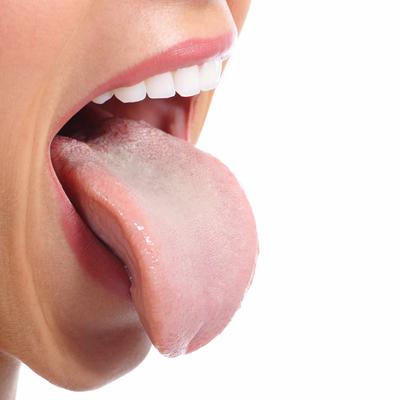 初期艾滋病舌頭癥狀有哪些