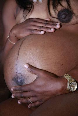 懷孕7個月生殖皰疹怎麼辦