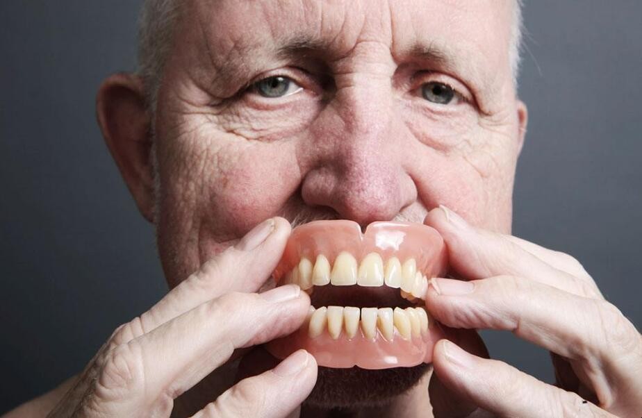 假牙有哪些種類